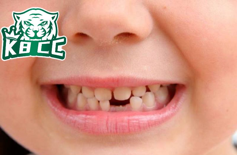 Giấc mơ gãy răng báo hiệu điều gì? Giải mã ý nghĩa chi tiết Nếu mơ gãy răng cửa dưới nên đánh các số 35, 53, 59